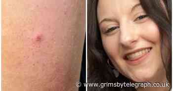 Student tells of 'emotional trauma' faced by spiking victims - Grimsby Live