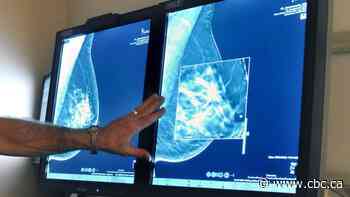 Breast cancer screening guidelines based on flawed Canadian study, new paper says