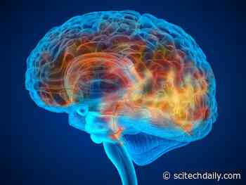 Physical Activity May Improve Alzheimer’s Disease by Lowering Brain Inflammation