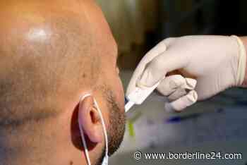 Bari, il 26 novembre test Hiv gratuito (e anonimo): ecco gli orari - Borderline24.com