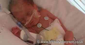 The miracle Grimsby baby who has had 10 operations to keep her alive - Grimsby Live