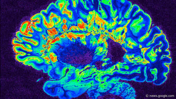 Nasal Alzheimer's Vaccine To Start Human Trials for the First Time - Interesting Engineering