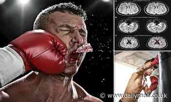 Health: Men who boxed as youngsters may be THREE times as likely to develop Alzheimer's