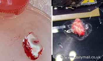 Slice of human BRAIN is kept alive in a petri dish for 12 hours for the first time