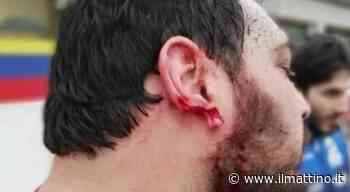 Rugby, orecchio staccato con un morso: condannato giocatore dell'Oderzo. La vittima: «Mai ricevuto scuse». L'omertà del club trevigiano - Il Mattino