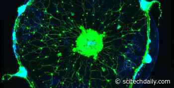 Caltech Researchers Read a Jellyfish’s Mind