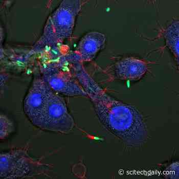 Researchers Use Nanoparticles To Kill Dangerous Bacteria That Hide Inside Human Cells