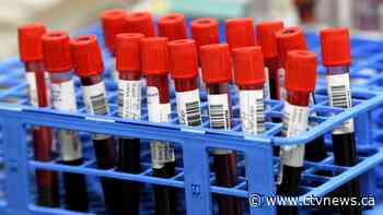 Canadian-developed screening test aims to detect early-stage cancer using blood samples