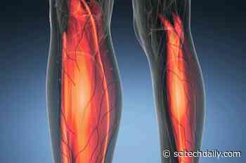 Muscle Loss Can Be Counteracted With Early Interventions