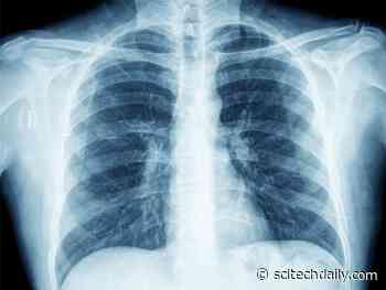 New Chest Imaging Database Assists AI in the COVID-19 Fight