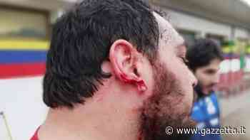 "Lobo staccato da un morso", 4 mesi al pilone dell'Oderzo. Il club: "Ricorso" - La Gazzetta dello Sport