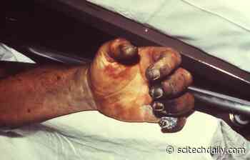 Plague of Justinian Was Nothing Like Flu and May Have Hit England Before Constantinople