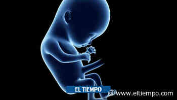 Médicos de Barranquilla operan a feto de 25 semanas en vientre de su mamá - ElTiempo.com