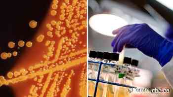 How to treat E. coli infections that cause kidney failure in children to be studied in Calgary