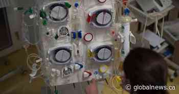 Calgary researcher to lead study on E. coli infection in children