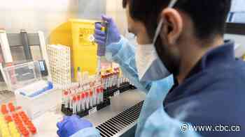 Omicron more transmissible but milder than delta variant, initial research suggests - CBC.ca