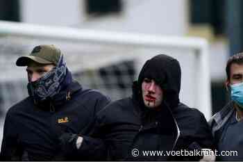 Beerschot-fan die veld betrad wel héél hardhandig aangepakt door politie: schedelbreuk en verbrijzelde oogkas