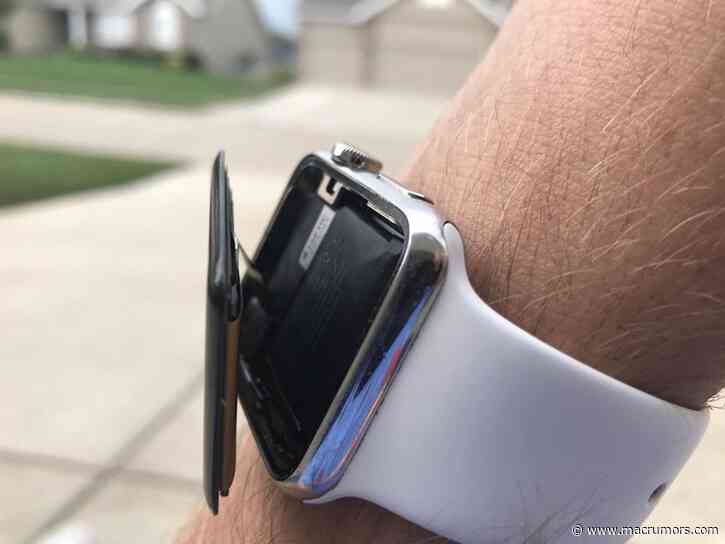 Lawsuit Claims Swollen Apple Watch Batteries Can Lead to 'Substantial Personal Injury'
