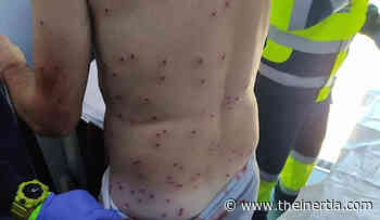 Mountain Biker Mistaken for Rabbit Shot on Trail in Spain - TheInertia.com