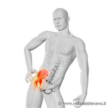 Salò Valsabbia Garda Valtenesi - La coxartrosi: cause e cure dell'artrosi dell'anca - Valle Sabbia News