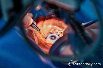 Cataract Surgery Linked With 30% Lower Risk of Dementia