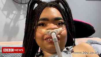 Shelby Lynch: TikTok influencer on dispelling disability myths