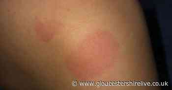 Woman claims she was victim of needle violence in nightclub - Gloucestershire Live