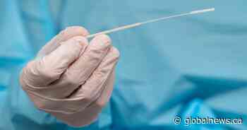 COVID-19: 5th Omicron variant case confirmed in Ottawa, linked to travel - Global News