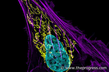Study can't confirm lab results for many cancer experiments – Chilliwack Progress - Chilliwack Progress