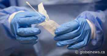 Scott Moe says despite Health Canada stats, Saskatchewan leads the way in rapid test deployment - Global News