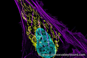 Study can’t confirm lab results for many cancer experiments - Comox Valley Record