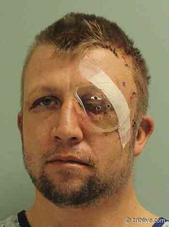 Shetler transferred to Westmoreland jail, claims additional medical care needed - TribLIVE