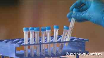 77 new COVID-19 cases reported in Sask.