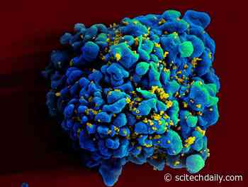 Experimental mRNA HIV Vaccine Safe, Shows Promise in Animals – Uses Same Technology As COVID-19 Vaccines