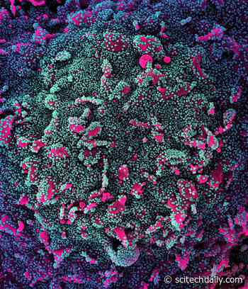 UCLA Breakthrough Points Way to Longer-Lasting COVID Vaccine