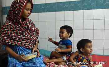 Conjoined Bangladesh Twins To Be Separated In Marathon Surgery - NDTV