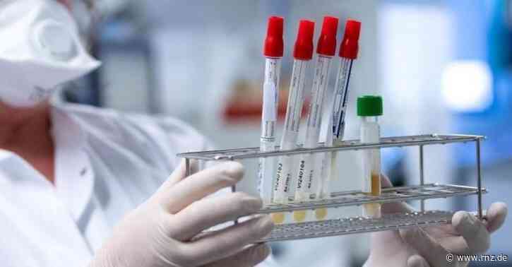 Heidelberg:  Sieben-Tage-Inzidenz sinkt weiter