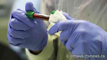 120 new COVID-19 cases in Ottawa as Ontario positivity rate rises - CTV Edmonton