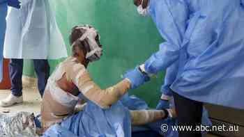 Official confirms fireball from overturned petrol tanker kills 75 in Haiti