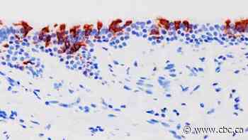 How does Omicron spread so fast? Virus may now be multiplying 70 times quicker in airways