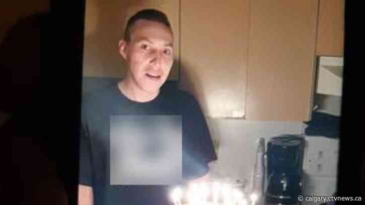 Calgary police seek missing man who recently suffered brain injury