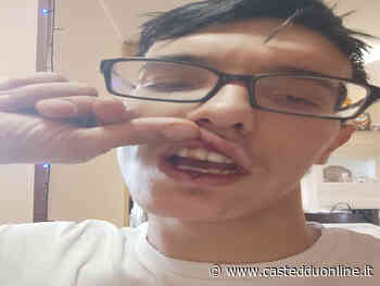 "Aggredito e rapinato da due stranieri armati a Selargius, mi hanno anche preso a pugni" - Casteddu Online