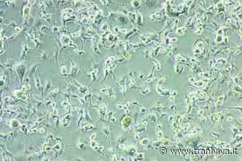 Isolata in Puglia la variante Omicron dall’Istituto Zooprofilattico Sperimentale - TraniViva