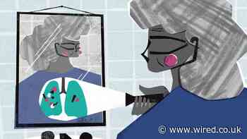 Self-Testing is a Feature of the Pandemic. It’s Here to Stay