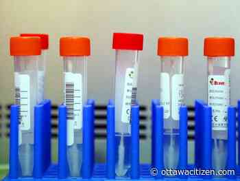 The new pandemic reality: Limited testing and do-it-yourself contact tracing