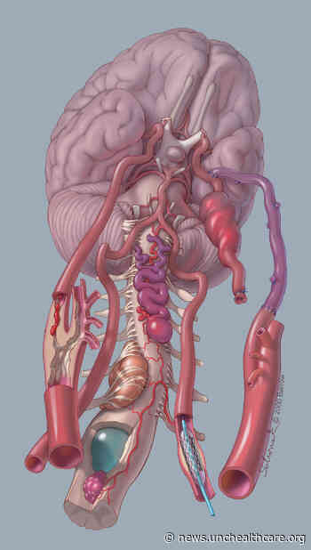 Medical Illustrator Mark Schornak will join the UNC Neurosurgery Team in 2022 | Newsroom - UNC Health and UNC School of Medicine