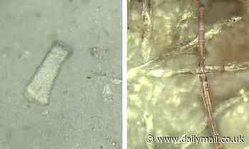 People with IBD have more microplastic in their faeces, study finds