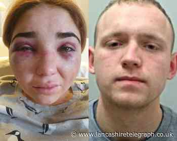 Blackburn man left pregnancy girlfriend 'vomiting blood' after assault