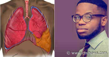 A medical illustrator noticed patients are always depicted as White. So, he decided to draw diverse medical diagrams. - CBS News