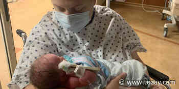 Baby is thriving after surgery to remove tumor while in the womb